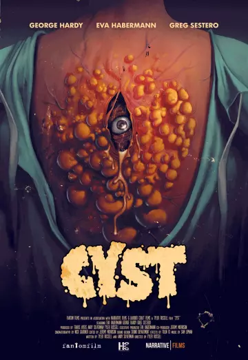 Cyst  [WEB-DL 720p] - FRENCH